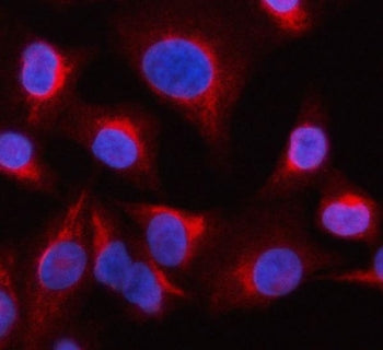 Immunofluorescent staining of FFPE human A549 cells with OCRL-1 antibody (red) and DAPI nuclear stai