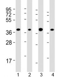 Western blot testing of human 1) HepG2, 2) Jurkat, 3) Li-7 and 4) RPMI-8226 cell lysate with ARHGEF3