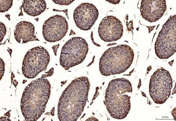 IHC staining of FFPE mouse testis tissue with TANK-binding kinase 1 antibody. HIER: boil tissue sect