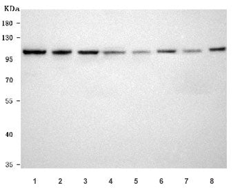EphB3 Antibody / Ephrin Receptor B3