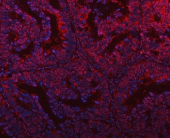 PLEKHG5 Antibody / Pleckstrin homology domain-containing family G member 5