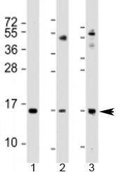 Western blot testing of 1) human A549 cell lysate, 2) mouse lung lysate and 3) mouse small intestine