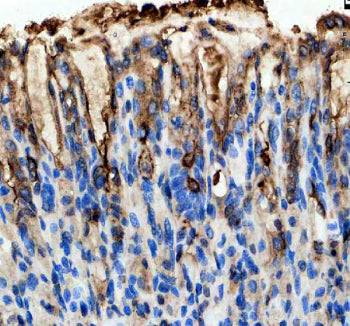 Immunohistochemical staining of GKN1 using anti-GKN1 antibody. GKN1 was detected in a paraffin-embed