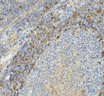 Immunohistochemical staining of CD42a/GP9 using anti-CD42a/GP9 antibody. CD42a/GP9 was detected in a
