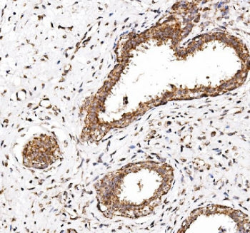 CALCOCO2 Antibody / NDP52