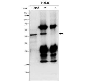 Immunoprecipitation of SCAD protein from 500ug of human HeLa whole cell lysate with SCAD antibody at