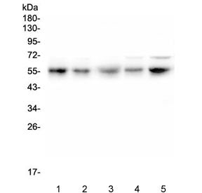 Western blot testing of human 1) U-2 OS, 2) PC-3, 3) U-87 MG, 4) A549 and 5) HeLa cell lysate with R