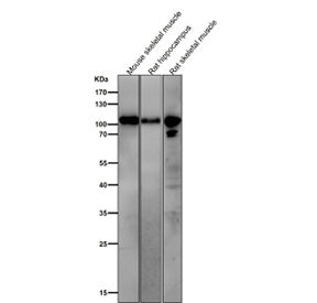 All lanes use the Phospho-AMPA Receptor 1 (Ser831) antibody at 1:1K dilution for 1 hour at room temp