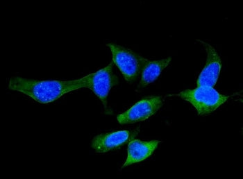 FABP5 Antibody (epidermal)