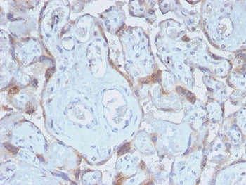 IHC staining of FFPE human placenta with recombinant TIMP2 antibody (clone TIMP2/2488R). Required HI