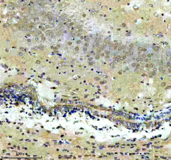 Immunohistochemical staining of CXXC5 using anti-CXXC5 antibody. CXXC5 was detected in a paraffin-em