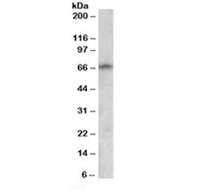 Western blot testing of human brain (cerebral cortex) lysate with GAD67 antibody at 0.5ug/ml. Predic