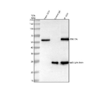 Immunoprecipitating STK17A in U251 whole cell lysate. Western blot analysis of STK17A using anti-STK