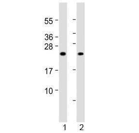 Western blot testing of 1) human skeletal muscle and 2) rat skeletal muscle lysate with MYL1 antibod
