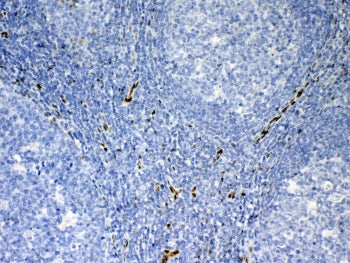 IHC testing of FFPE human tonsil tissue with IL-33 antibody at 1ug/ml. Required HIER: steam section
