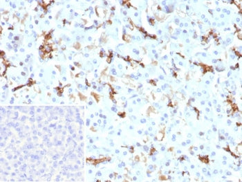 CFTR Antibody / Cystic Fibrosis Transmembrane Regulator