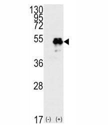 p53 Antibody