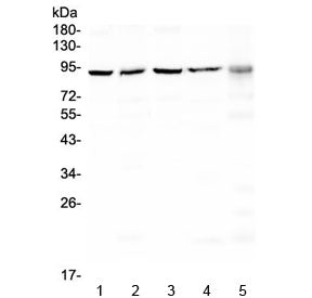 PRDM1 Antibody / BLIMP1