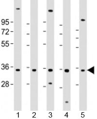 Western blot testing of human 1) HL-60, 2) K562, 3) MCF-7, 4) MOLT-4 and 5) SH-SY5Y cell lysate with