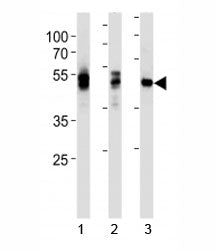 LCK antibody western blot analysis in 1) HL-60, 2) Jurkat and 3) NCI-H292 lysate. Predicted molecula
