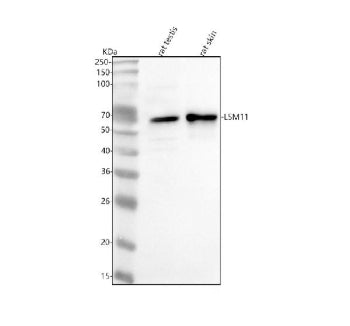 Western blot analysis of LSM11 using anti-LSM11 antibody. Lane 1: rat testis tissue lysates, Lane 2: