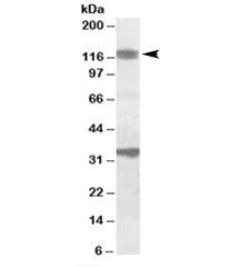 Western blot testing of rat skeletal muscle lysate with CCAR1 antibody at 1ug/ml. Predicted molecula