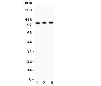 Western blot testing of GRIK1 antibody and Lane 1: mouse brain; 2: mouse brain; 3: human SHG-44 (gli