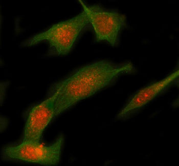 Immunofluorescent staining of STX12 using anti-STX12 antibody (red) and anti-Beta Tubulin antibody (