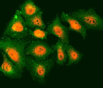 Immunofluorescent staining of FFPE human A549 cells with Tropomodulin 2 antibody (red) and Beta Tubu