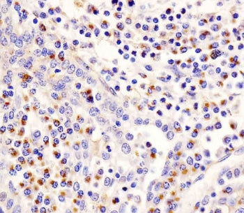 IHC testing of FFPE human tonsil tissue with Lp-PLA2 antibody. HIER: steam section in pH6 citrate bu