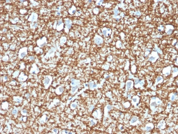 IHC staining of FFPE human brain with ARF1 antibody (clone ARF1/2117). HIER: boil tissue sections in