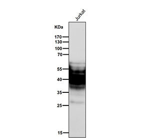 All lanes use the SYPL1 antibody at 1:3K dilution for 1 hour at room temperature. SYPL1 (~28 kDa pre