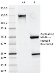 CD20 Antibody