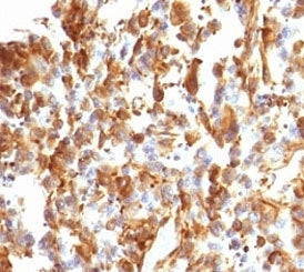 Vimentin Antibody