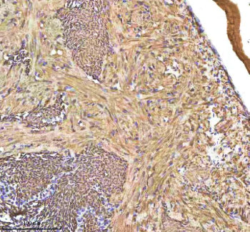 IHC staining of FFPE zebrafish heart tissue with Hbae1.1 antibody, HRP-labeled secondary and DAB sub