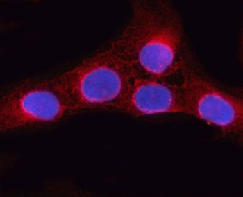 Immunofluorescent staining of FFPE human U-2 OS cells with ORP9 antibody (red) and DAPI nuclear stai