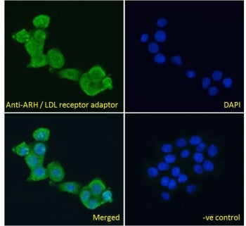 ARH Antibody