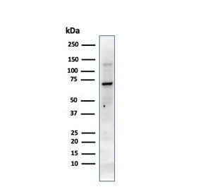 Western blot testing of human JEG-3 cell lysate with Placental Alkaline Phosphatase antibody (clone