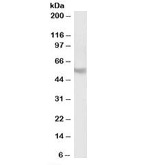 PPP2R5B Antibody