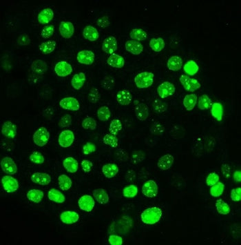 Ki67 Antibody