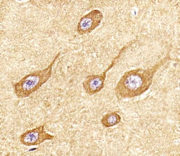 IHC testing of FFPE human brain tissue with STMN2 antibody. HIER: steam section in pH6 citrate buffe