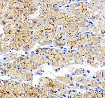 Immunohistochemical staining of OCLN using anti-OCLN antibody. OCLN was detected in a paraffin-embed