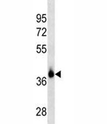 EpCAM Antibody