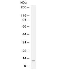 Western blot testing of human Jurkat cell lysate with MGP antibody. Expected molecular weight ~10 kD