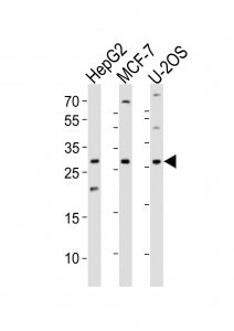 Western blot analysis of lysate from HepG2, MCF-7, U-2OS cell line (left to right) using ID1 antibod
