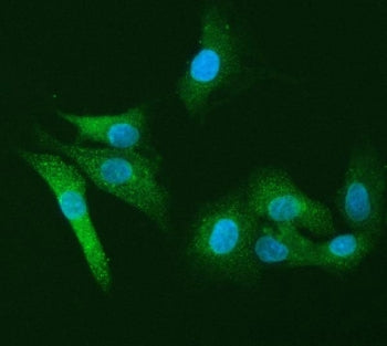 Immunofluorescent staining of FFPE human A549 cells with Leukocyte elastase inhibitor antibody (gree