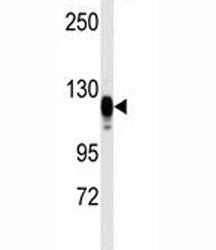 Epidermal growth factor receptor Antibody (EGFR)