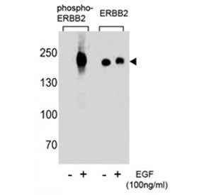 HER2 Antibody (ERBB2) (phospho-Y1248)