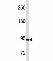 PR antibody western blot analysis in SK-BR-3 lysate. Expected molecular weight: 82-94 kDa (isoform A