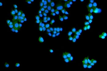 RAB5 Antibody / RAB5A/B/C